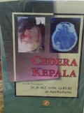 Cedera kepala